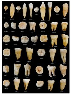 Our early African ancestors went first to Asia, not Europe. Humans arrived in China 30,000 years earlier than expected. African Ancestors, Human Migration, Journal Nature, Dental Anatomy, Loose Tooth, Fossil Teeth, Oil Pulling