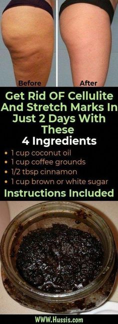 Skincare Hacks, Baking Soda Shampoo, Skin Care Remedies, Skin Products, Skin Care Recipes, Diy Skin Care, Whitening Cream, Beauty Skin Care Routine