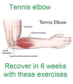 Elbow Exercises Physical Therapy, Elbow Pain Relief Exercise, Tennis Elbow Relief Remedies, Tennis Elbow Relief Exercises, Tennis Elbow Exercises Physical Therapy, Tennis Elbow Stretches, Tennis Elbow Relief, Elbow Stretches, Tennis Elbow Symptoms