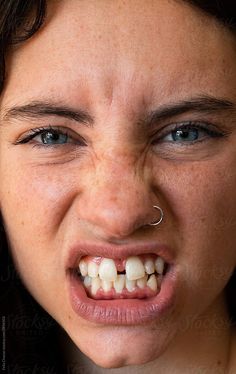 a woman with braces on her teeth and piercing in front of her mouth, looking at the camera