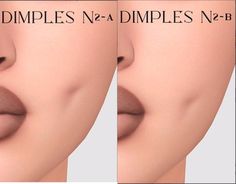 two images of the same woman's lips with different shapes and sizes, one showing her nose