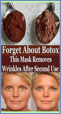 Eliminate Wrinkles, Deep Wrinkles, Look Older