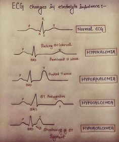 Electrolyte Imbalance, Medical Assistant Student, Nursing School Essential, Medical School Life, Nursing School Motivation, Nurse Study Notes, Nursing Mnemonics, Nursing Student Tips, Medical Student Study