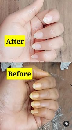 Diy Nail Whitener, How To Get Whiter Nails At Home, How To Clean Yellow Nails, Get Rid Of Yellow Nails, How To Get Nails White, How To Whiten Fingernails, How To Whiten Nails Naturally, How To Whiten Yellow Nails, How To Remove Yellow Stains From Nails