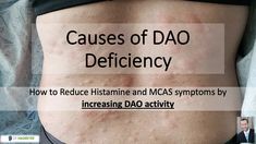 DAO Deficiency- How To Activate The Enzyme That Reduces Histamine Intolerance and MCAS Symptoms. | Dr. Hagmeyer Dao Boosting Foods, Mcas Symptoms, Antihistamine Diet, Autonomic Dysfunction, Mast Cell Activation