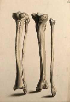 two bones are shown in black and white, one is showing the lower half of the bone