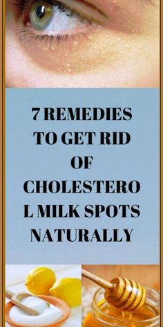 7 Remedies To Get Rid Of Cholester by maria Carter | This newsletter was created with Smore, an online tool for creating beautiful newsletters for educators, nonprofits, businesses and more Forward Head Posture Exercises, Birthday Cakes For Her, Skin Disorders, Essential Oil Uses, Yoga For Beginners, Fitness Diet, Healthy Drinks, Beauty Care, Immune System