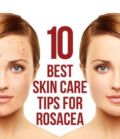 Redness Face, Redness On Face, Face Facial, Inflammatory Foods, Best Skin Care, Sensitive Skin Care, Best Skin, Healthy Skin Care, Moroccan Oil