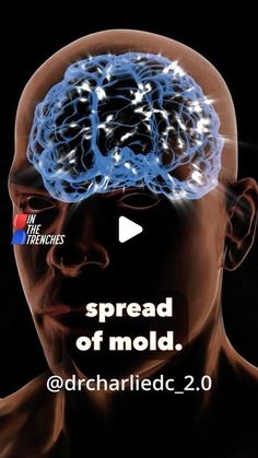 Dr. Charlie Fagenholz DC CPCRA on Instagram: "From my deep-dive on mold/fungus/yeast/mycotoxins video in the membership. Mold/fungal/yeast issues are so overlooked in medicine today. If you struggle with things like memory, fatigue, skin, teeth grinding,feeling spaced out, immunity and or odor issues then I would suggest looking into this as being a possible culprit. There are many more symptoms that it can cause compared to what I listed but those are some of the main ones!

Also, if you have lived in a known moldy place then this video is a must for you as well.

Comment LINK in the comments section below and I will DM you a direct link to where you can watch this full video!" Fifth Dimension, Teeth Grinding, Cleaning Mold, Elder Care, Easy Face Masks, Herbal Healing, Grinding Teeth, Elderly Care, Physical Wellness