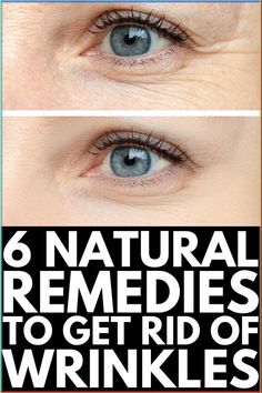 6 Natural Remedies for Wrinkles | If you’re looking for anti-aging tips and tricks to help you prevent and get rid of wrinkles, we’re sharing 6 ways to banish wrinkles naturally. Whether you have fine lines on your forehead, under your eyes, around your mouth, on your lips, on your face, and/or on your neck, these DIY beauty hacks and face masks will reduce the appearance of wrinkles and fine lines fast. #getridofwrinkles #antiaging #skincare Home Remedies For Wrinkles, Hair Fall Remedy, Get Rid Of Wrinkles, Wrinkle Remedies, Under Eye Wrinkles, Fall Makeup Looks, Face Wrinkles, Eye Wrinkle