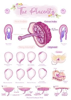 Midwife Notes, Obstetric Ultrasound, Nursing School Inspiration, Diagnostic Medical Sonography, Labor Nurse