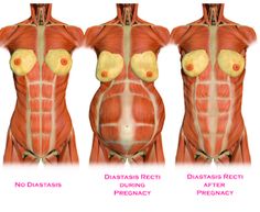 the muscles are shown in three different positions, and each is labeled with an arrow