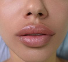 Trucco Glam, Facial Aesthetics, Lip Shapes, Lip Injections