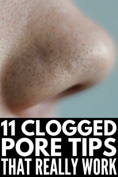 Want to know how to get rid of clogged pores on your nose, chin, cheeks, and/or forehead? We're sharing our fave tips, remedies and products that work fast! Underarm Hair Removal, Newborn Feeding, Womens Health Care, Brown Spots Removal, Skin Natural Remedies, Natural Cold Remedies, Natural Cough Remedies, Cough Remedies, Cold Remedies