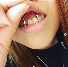 a woman is holding two metal clips to her teeth