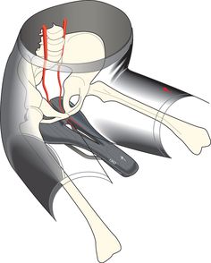 an image of the inside of a bowl with scissors and blood vessels attached to it