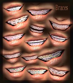 a bunch of white teeth are arranged in the shape of a smile, with different angles and sizes