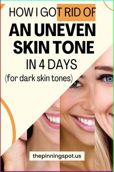 Looking for a solution to even out your skin tone? In this post, you'll learn effective remedies to treat uneven skin tone on the face and body. Explore DIY skincare for dark skin, focusing on how to remove pigmentation and achieve a beautifully even complexion.   you'll also learn effective homemade beauty tips for face to banish dark spots and hyperpigmentation to become fair skin naturally How To Even Skin Tone On Face, How To Treat Uneven Skin Tone, Even Skin Tone Diy, Natural Skin Lightening Diy, How To Fix Uneven Skin Tone, How To Even Out Skin Tone, Uneven Skin Tone Remedies, Skincare For Dark Skin, Even Skin Tone Naturally