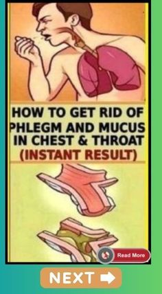 Mucus In Chest, Getting Rid Of Phlegm, Health Articles Wellness, Health Signs, Women Health Care, Health And Fitness Articles, Natural Health Tips, Disease Prevention