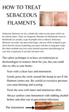 sebaceous filaments the ordinary |
sebaceous filaments products |
sebaceous filaments nose treatment |
sebaceous filaments removal tool |
sebaceous filaments treatment dermatologist |
sebaceous filaments home remedy Nose Pores Remedy, Sebaceous Filaments How To Get Rid Of, Sebaceous Filaments Skincare, Sebatious Filaments, How To Get Rid Of Sebaceous Filaments, Sebaceous Filaments Removal, Body Knowledge, Sebaceous Filaments, Different Types Of Acne