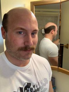 Middle Haircut, Moustaches Men, Bald Men Style, Beard Men, Bald Look, Yul Brynner, Mustache Styles, Male Pattern Baldness, Bald Spot