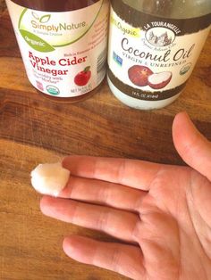 Warts are annoying, but common! Here's how you can use apple cider vinegar for warts to effectively get rid of them for good. Planter Warts Remedies, Plantar Wart Removal, Natural Wart Remover, Planters Wart, Natural Wart Remedies, Home Remedies For Warts