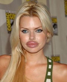 Lip Plastic Surgery, Lip Augmentation, Duck Face, Estilo Punk, Crazy Girls