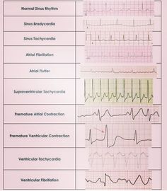 Emt Study, Medical Terminology Study, Nursing School Life, Nurse Skills, Medical Assistant Student, Nursing School Essential, Medical School Life, Nurse Study Notes, Nursing Student Tips