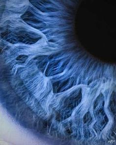 the iris of an eye is blue with white streaks on it's outer part