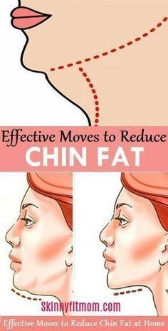 Být Fit, Reduce Double Chin, Double Menton, Neck Exercises, Face Yoga