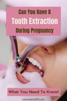 tooth extraction during pregnancy Pregnancy Second Trimester, Second Trimester