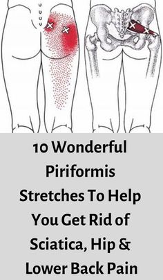 Piriformis Stretch Exercises, Stretches For Sciatica, Piriformis Stretch, Sciatica Exercises, Coconut Health Benefits, Sciatic Nerve Pain, Sciatica Pain, Sciatic Nerve, Back Pain Exercises