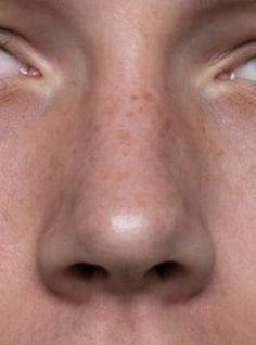 a close up of a person's face with freckles on their eyes