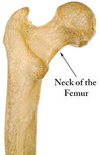 Increase Femoral Neck Bone Density for Osteoporosis and Osteopenia Yoga For Osteoporosis, Proper Squat Form, Clean Arteries, Neck Bone