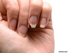 Comment Renforcer Des Ongles Mous Et Cassants Fix Broken Nail, Split Nails, Cracked Nails, Weak Nails, Kidney Cleanse, Broken Nails, Nail Repair, Brittle Nails