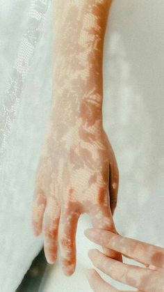 a woman's arm and hand with white skin on it