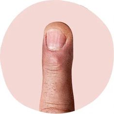 Your nails are like a map to what’s going on inside your body. Find out what your nails are telling you and how to respond. Health Chart, Skin Bumps, Us Food, Happy Nails, Lines On Nails, Brittle Nails, Natural Therapy