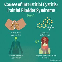 Causes of Interstitial Cystitis/Painful Bladder Syndrome Painful Bladder Syndrome Diet, Yoga For Bladder Control, Bladder Irritants Food, Intercystial Bladder, Intersistial Bladder, Pessary For Bladder Prolapse, Pelvic Pain Relief, Bladder Health