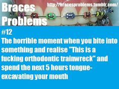 Braces Problems Braces Journey