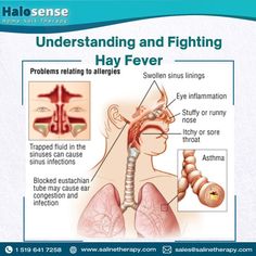 Understanding and Fighting Hay Fever Swollen Sinuses, Ear Congestion, Clear Your Sinuses, Nasal Obstruction, Salt Therapy, Medical Device Design, Throat Infection, Strep Throat