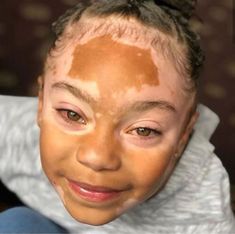 Melanin. Vitiligo Babies Images, Natural Hair Community, Swag Style, Kids' Fashion, Black Is Beautiful, Baby Fever, Tanning, Baby Love, Mocha