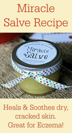 My friend swears by this homemade eczema cream! Miracle Salve Recipe for Hands, Face & Body from Primally Inspired Homemade Salve, Diy Lotion, Scaly Skin, Homemade Lotion, Labels Printables Free, Homemade Bath Products, Diy Body