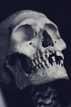 a black and white photo of a human skull