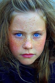 Girl With Freckles, Freckle Face