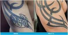 before and after photos of a tattoo cover up on a man's left arm