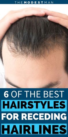 Men’s Hair Styles For Receding Hairline, Men Receding Hairline Hairstyles, Hairstyles For Men With Receding Hair, Haircut For Men With Big Foreheads, Men Haircut Thinning Hair, High Hairline Hairstyles Men, Hairstyle For Receding Hairline Mens, Receding Hairline Hairstyle, Mens Hairstyles Receding Hairline