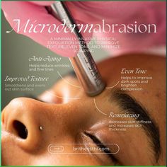 Hey, have you met my friend Microderm? Mircodermabrasion has been used in spas for about 40 years. There’s two methods of this treatment, crystal and crystal-free or diamond tip. At BTE Luxe, we offer diamond tip microdermabrasion for the face and body. This treatment is a non invasive, physical exfoliation method that resurfaces the skin offering aid with acne, texture, and aging. The skin feels soft and subtle following the treatment and also provides an improved base for your skincare ... Acne Texture, Tightening Loose Skin, Natural Wrinkle Remedies, Microdermabrasion Benefits, Esthetician Inspiration, Diamond Microdermabrasion, Facial Massage Techniques, Wedding Skincare