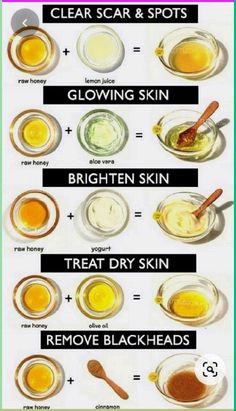 Discover the secrets to banishing dark circles for brighter, more youthful eyes! Learn about the benefits of clearing dark circles and expert tips on how to use the right products effectively. Say goodbye to tired eyes and hello to a refreshed look! \n#DarkCircleSolutions #EyeCareTips #SkincareRoutine #BrightEyes Homemade Makeup Remover, Olive Oil Skin, Reduce Eye Bags, Eye Gel Pads, Homemade Makeup, Honey Yogurt, Blackheads Removal, Charcoal Face Mask, Drugstore Skincare