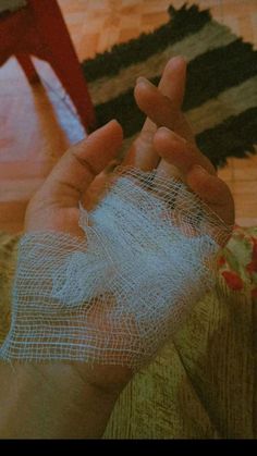 a person with bandages on their hands sitting on a couch next to a red chair