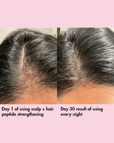 Whether you're dealing with hair fall, weak and brittle hair, or simply want to maintain healthy and strong hair, Saturday Skin Scalp + Hair Strengthening Peptide Treatment is your solution. Formulated with a powerful blend of strengthening peptides, this treatment is designed to nourish and strengthen your hair from the scalp down to the tips. The lightweight formula is gentle yet effective, helping to fortify and protect your hair against damage, breakage, and hair fall. In addition to its str Saturday Skin, Skin Essence, Pore Cleansing, Brittle Hair, Hair Fall, Bright Skin, Hair Strengthening, Strong Hair, Face Sunscreen